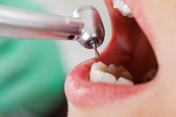 Best Dentist for Tooth Abscess  in Batesville, AR